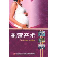 剖宫产术（VCD）