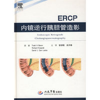 内镜逆行胰胆管造影ERCP