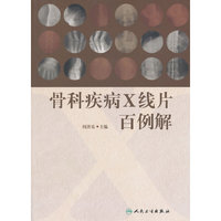 骨科疾病X线片百例解