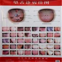 望舌诊病挂图-附说明书