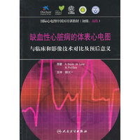 缺血性心脏病的体表心电图--与临床和影像技术对比及预后意义