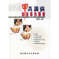 甲真菌病诊治彩色图谱(精)