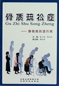 骨质疏松症：静悄悄的流行病