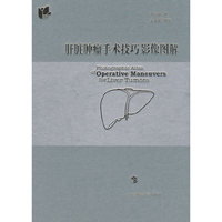 肝脏肿瘤手术技巧影像图解