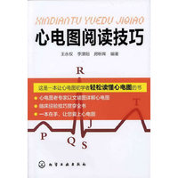 心电图阅读技巧