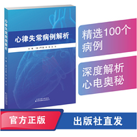 心律失常病例解析