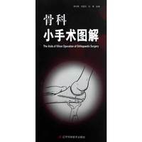 骨科小手术图解