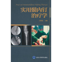 实用髓内钉治疗学