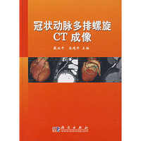冠状动脉多排螺旋CT成像