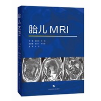 胎儿MRI