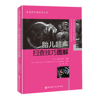胎儿超声扫查技巧图解
