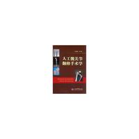 人工髋关节翻修手术学