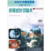 肝尾状叶切除术（DVD）