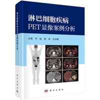 淋巴细胞疾病PET显像案例分析