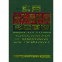 实用皮肤病性病彩色图谱